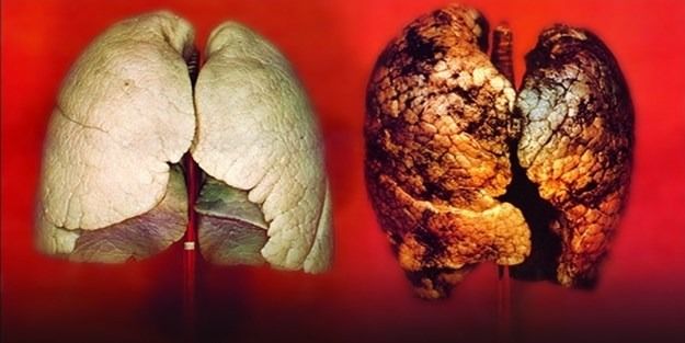 خرچنگله مبارزه ده داها جدی بیر آددیم