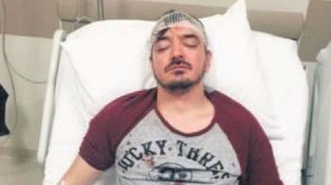 Məşhur müğənni bıçaqlandı - Foto