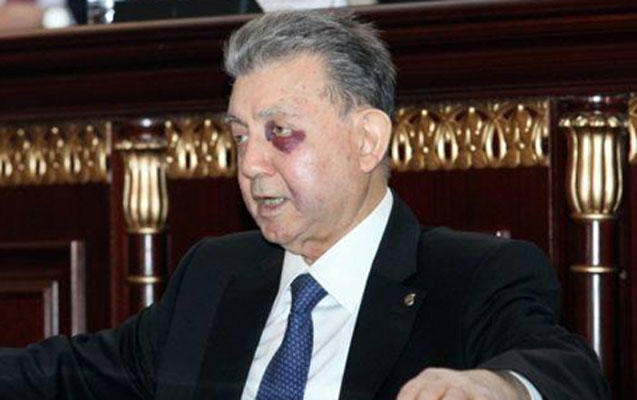 Akif Əlizadə əməliyyat olunub -