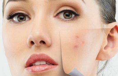 خطر «مثلث مرگ» روی صورت