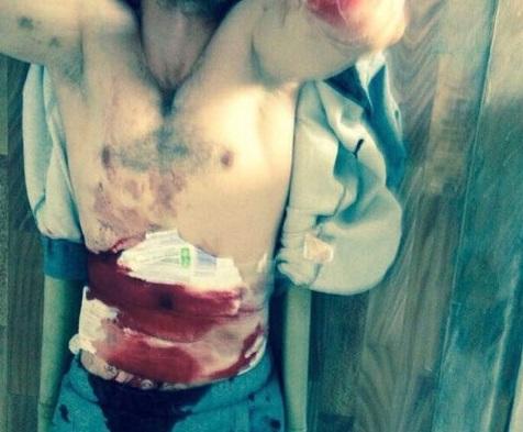 شامپیون تجریدخانادا خاراکیری ائتدی - ویدئو