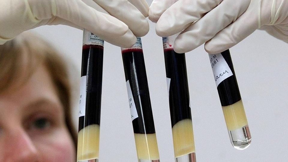 'Alarming' one in five deaths due to sepsis
