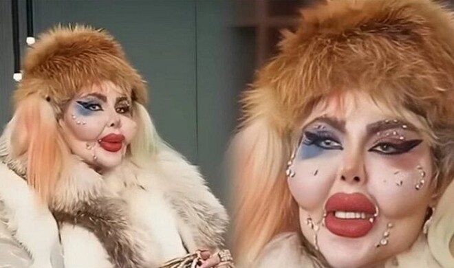 آناهیتا ناچو ۳۸۸ عمل زیبایی انجام داده است