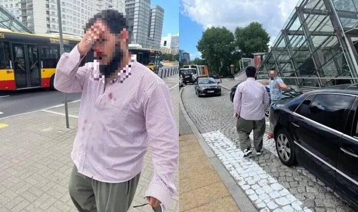 Polşada azərbaycanlı sürücüyə hücum - Foto