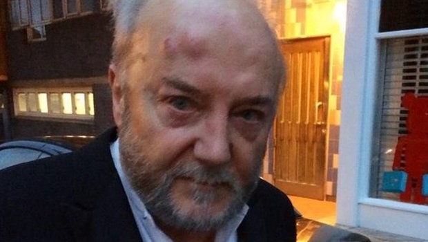 İsraili tənqid etdi və vəhşicəsinə döyüldü - Foto