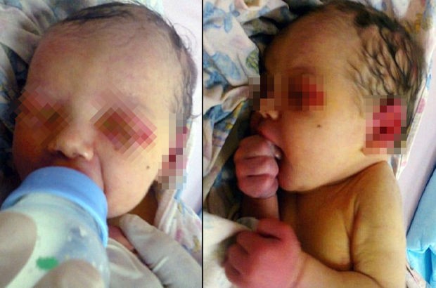 3 günlük körpəni qarışqalar yedi – Foto