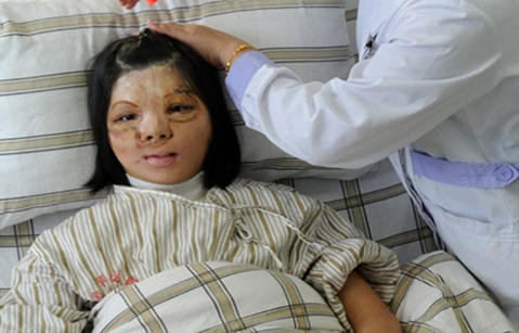 Sinəsindən üz düzəltdilər